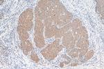 PKIB Antibody in Immunohistochemistry (Paraffin) (IHC (P))