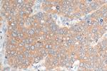 PKIB Antibody in Immunohistochemistry (Paraffin) (IHC (P))