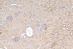 PKIB Antibody in Immunohistochemistry (Paraffin) (IHC (P))