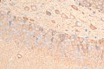 PKIB Antibody in Immunohistochemistry (Paraffin) (IHC (P))
