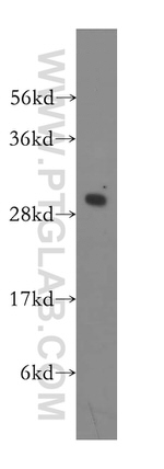 PSMA4 Antibody in Western Blot (WB)