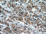 STEAP4 Antibody in Immunohistochemistry (Paraffin) (IHC (P))