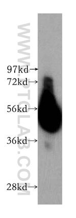 STEAP4 Antibody in Western Blot (WB)