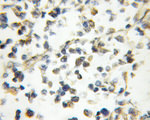 ST7 Antibody in Immunohistochemistry (Paraffin) (IHC (P))