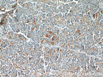 ST7 Antibody in Immunohistochemistry (Paraffin) (IHC (P))
