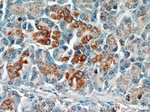 ST7 Antibody in Immunohistochemistry (Paraffin) (IHC (P))