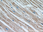 ST7 Antibody in Immunohistochemistry (Paraffin) (IHC (P))