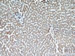 ST7 Antibody in Immunohistochemistry (Paraffin) (IHC (P))