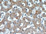 ST7 Antibody in Immunohistochemistry (Paraffin) (IHC (P))
