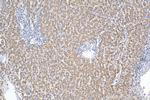 ST7 Antibody in Immunohistochemistry (Paraffin) (IHC (P))