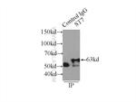 ST7 Antibody in Immunoprecipitation (IP)