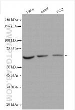 ST7 Antibody in Western Blot (WB)