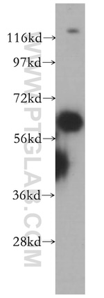 ST7 Antibody in Western Blot (WB)