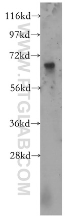ST7 Antibody in Western Blot (WB)