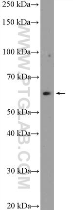 ST7 Antibody in Western Blot (WB)