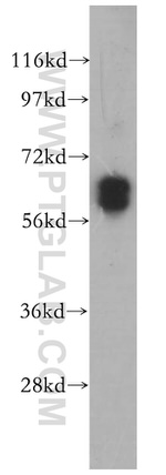 ST7 Antibody in Western Blot (WB)