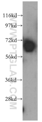 ST7 Antibody in Western Blot (WB)