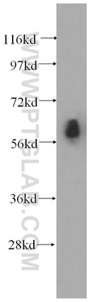 ST7 Antibody in Western Blot (WB)