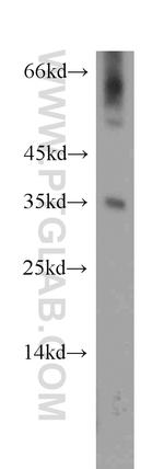 DOK5 Antibody in Western Blot (WB)