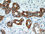 RHCG Antibody in Immunohistochemistry (Paraffin) (IHC (P))