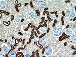 RHCG Antibody in Immunohistochemistry (Paraffin) (IHC (P))