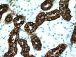 RHCG Antibody in Immunohistochemistry (Paraffin) (IHC (P))