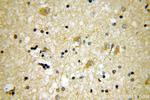 PSTPIP1 Antibody in Immunohistochemistry (Paraffin) (IHC (P))