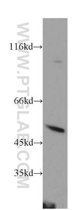 PSTPIP1 Antibody in Western Blot (WB)