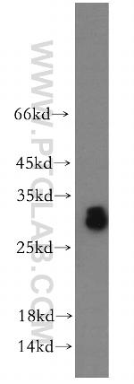 ASB9 Antibody in Western Blot (WB)