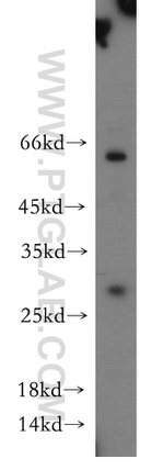 ASB9 Antibody in Western Blot (WB)