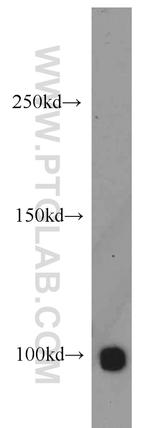 HELLS Antibody in Western Blot (WB)