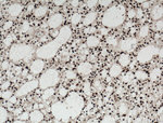 SUB1 Antibody in Immunohistochemistry (Paraffin) (IHC (P))