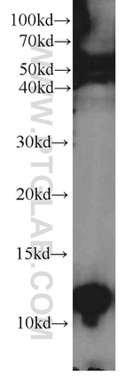 PCBD2 Antibody in Western Blot (WB)