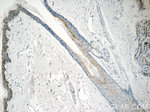 SPRR1B Antibody in Immunohistochemistry (Paraffin) (IHC (P))