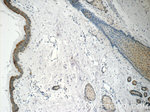 SPRR1B Antibody in Immunohistochemistry (Paraffin) (IHC (P))