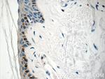 SPRR1B Antibody in Immunohistochemistry (Paraffin) (IHC (P))