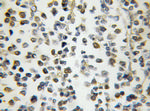 NPM3 Antibody in Immunohistochemistry (Paraffin) (IHC (P))
