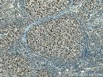 NPM3 Antibody in Immunohistochemistry (Paraffin) (IHC (P))