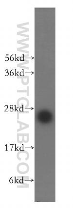 EMG1 Antibody in Western Blot (WB)