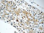 FXYD4 Antibody in Immunohistochemistry (Paraffin) (IHC (P))