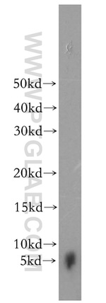 FXYD4 Antibody in Western Blot (WB)