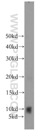 FXYD4 Antibody in Western Blot (WB)