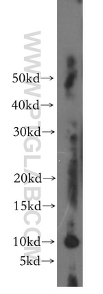 FXYD4 Antibody in Western Blot (WB)
