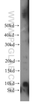 FXYD4 Antibody in Western Blot (WB)