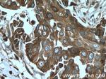 AGR3 Antibody in Immunohistochemistry (Paraffin) (IHC (P))