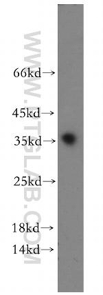 PPP1R2P9 Antibody in Western Blot (WB)