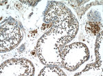 HSFY1 Antibody in Immunohistochemistry (Paraffin) (IHC (P))