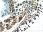 HSFY1 Antibody in Immunohistochemistry (Paraffin) (IHC (P))