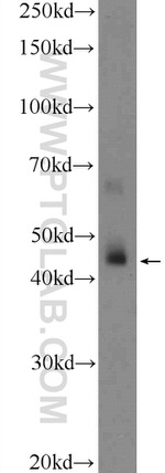 HSFY1 Antibody in Western Blot (WB)