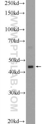 HSFY1 Antibody in Western Blot (WB)